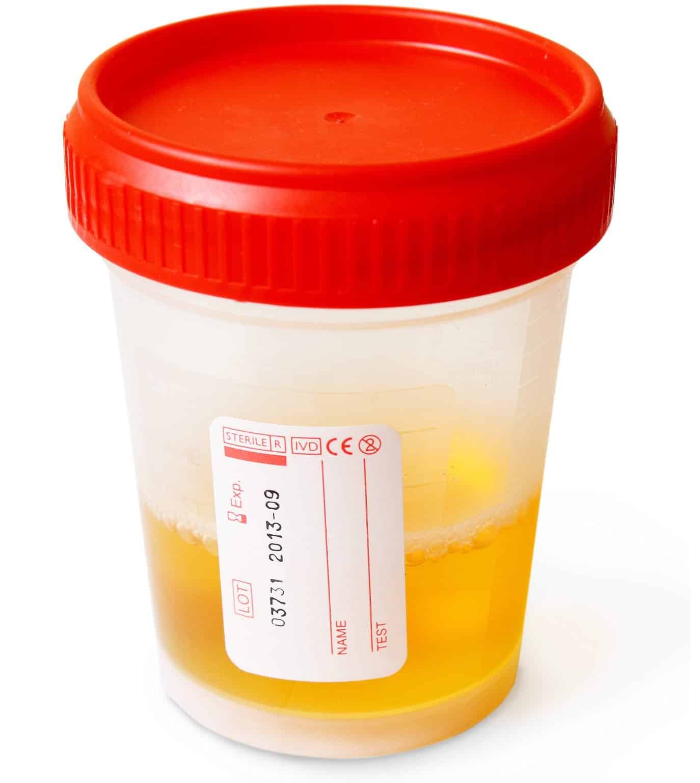 Understanding the Basics of 5 Panel Drug Tests The Screening Source