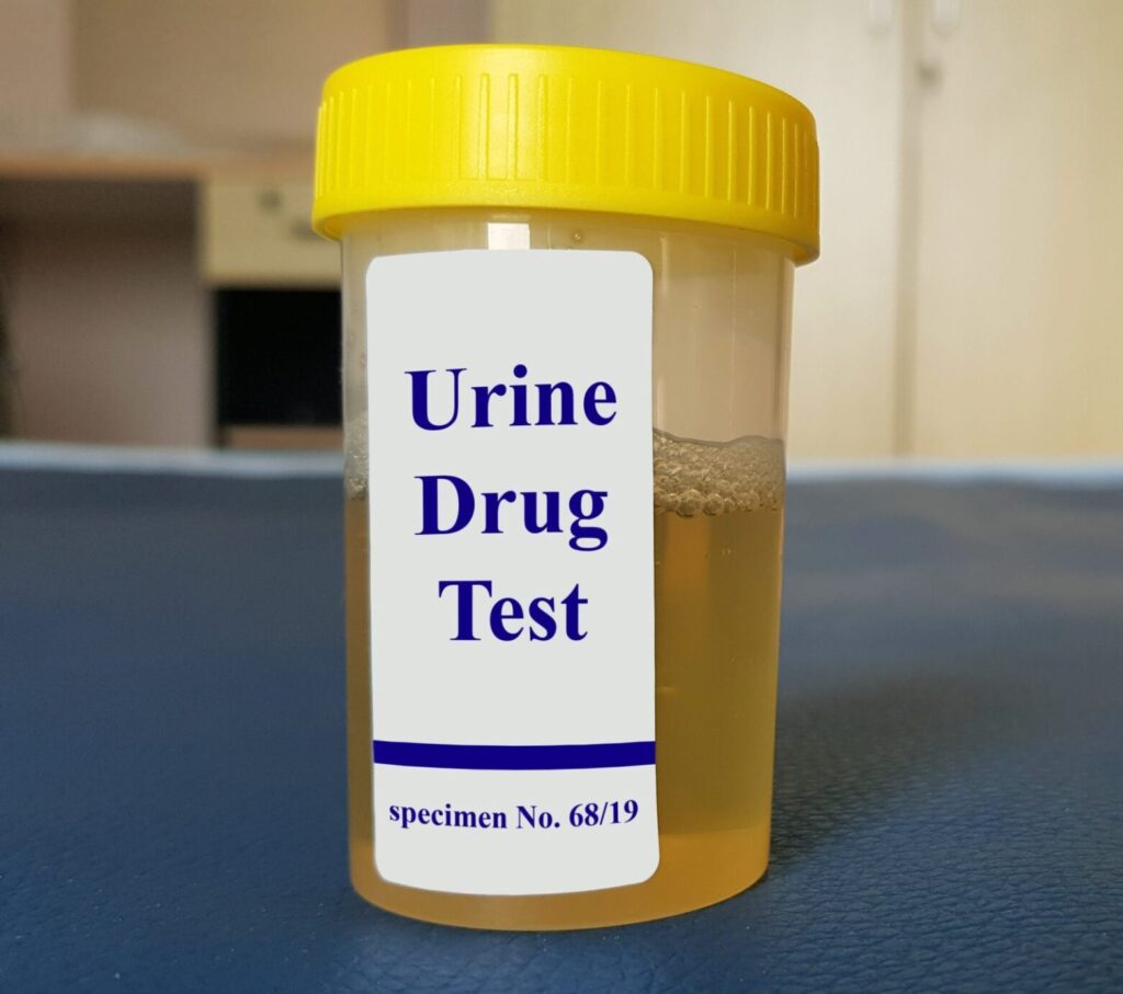 pre-employment drug testing