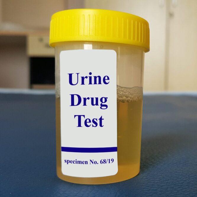 pre-employment drug testing